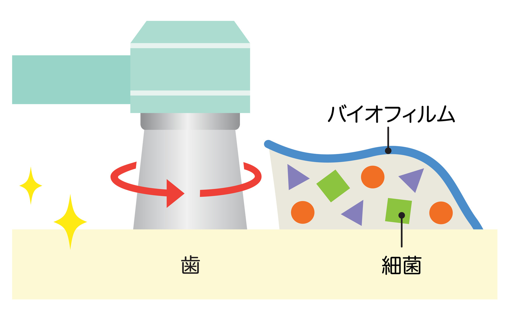 歯磨きで落ちないステインもエアフローでケア